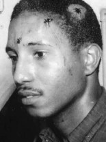 SNCC's Bernard Lafayette after Selma beating, 1963  